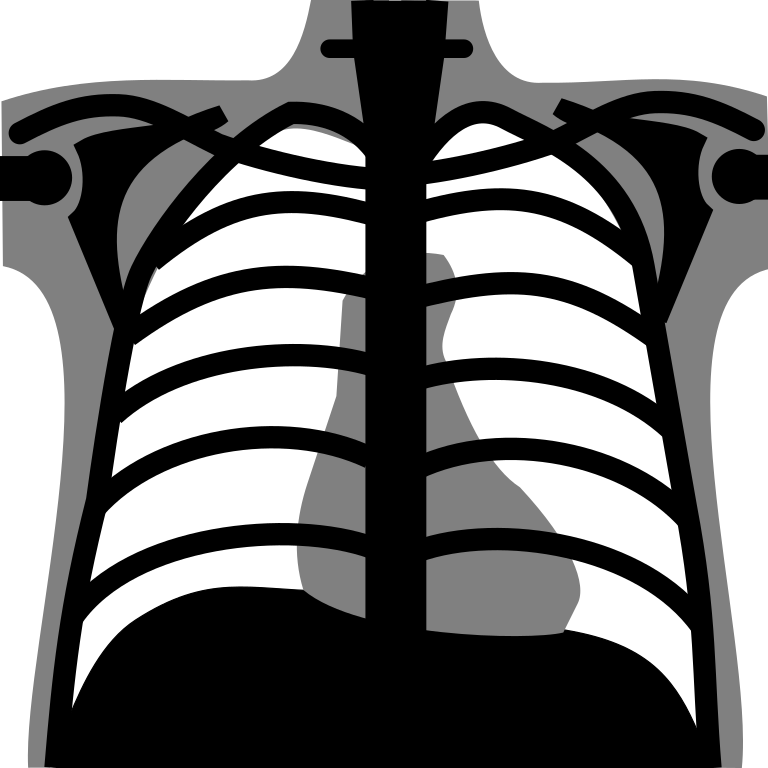 Black And Gray Chest X Ray Rib Cage Symbol With Shoulder Bones PNG Artwork