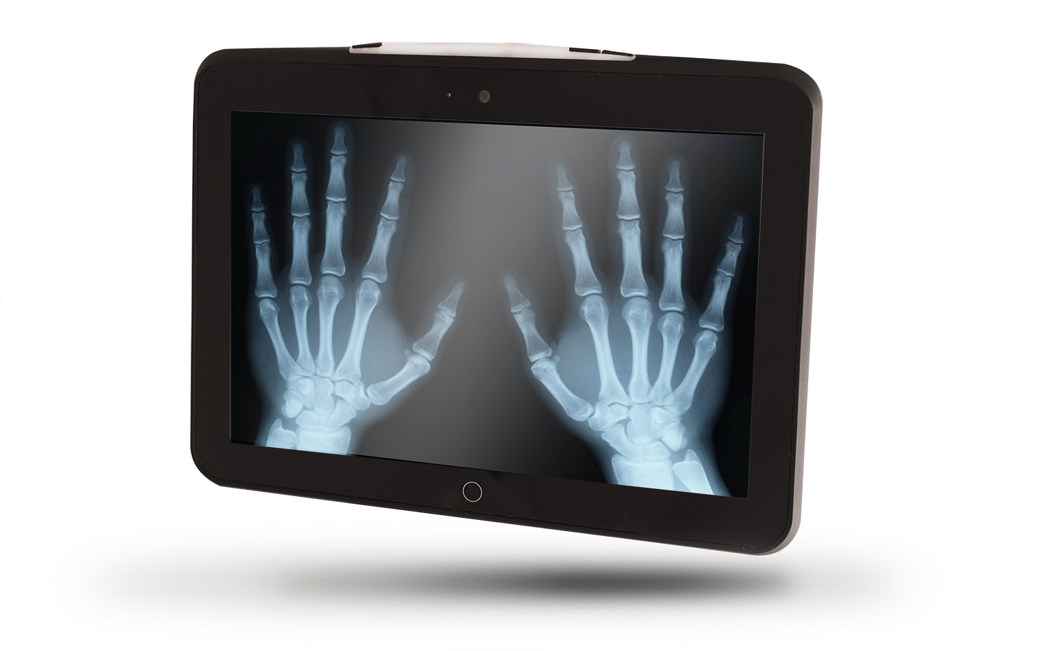 Black Tablet Showing Hand X-Ray Scans