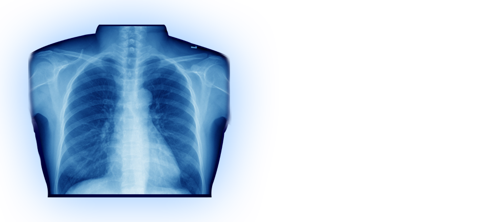 Blue Glowing Chest Radiograph Of Human Lungs And Rib Cage PNG Artwork