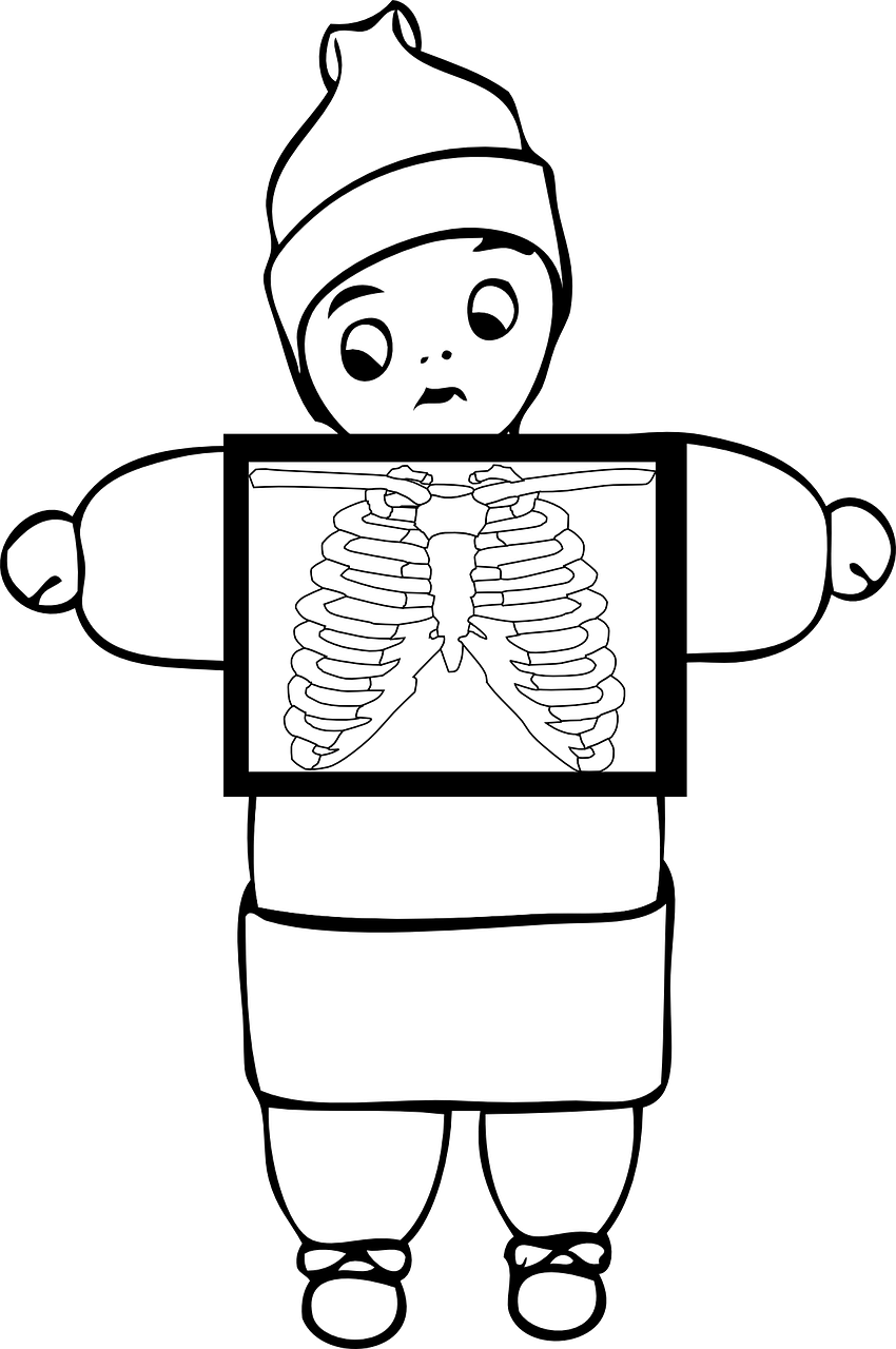 Cartoon Child Standing With Chest X Ray Film PNG Medical Illustration