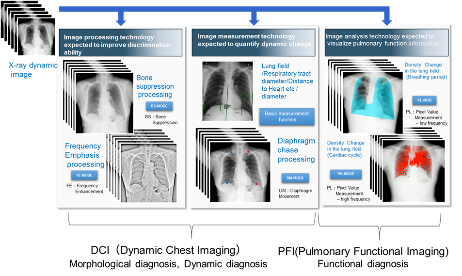 Dental Imaging Technology Comparison Chart With Radiograph Examples PNG Diagram
