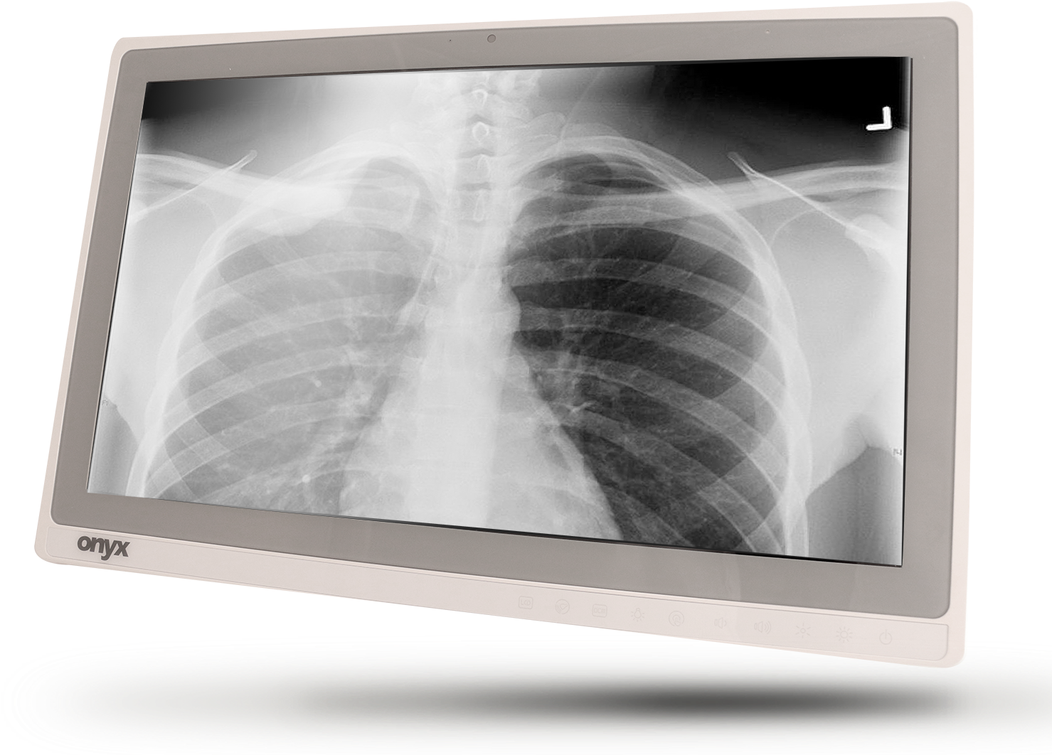 Tablet Computer Showing Frontal Chest X Ray Medical Display PNG Product Image