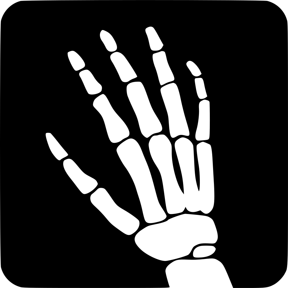 White Hand And Wrist Bone X Ray Symbol On Black Background PNG Icon