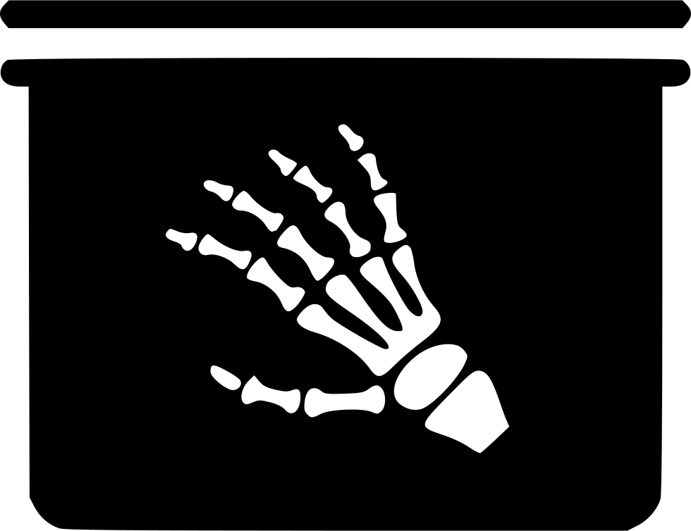 White Hand Bone X Ray Silhouette On Black Square Background PNG Graphic