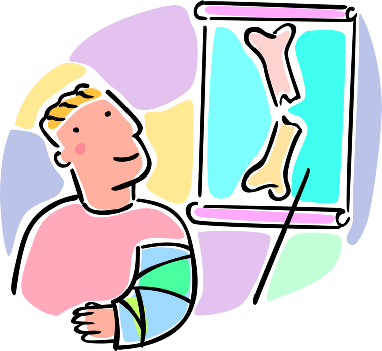 Cartoon Patient with Arm Cast Viewing X-Ray