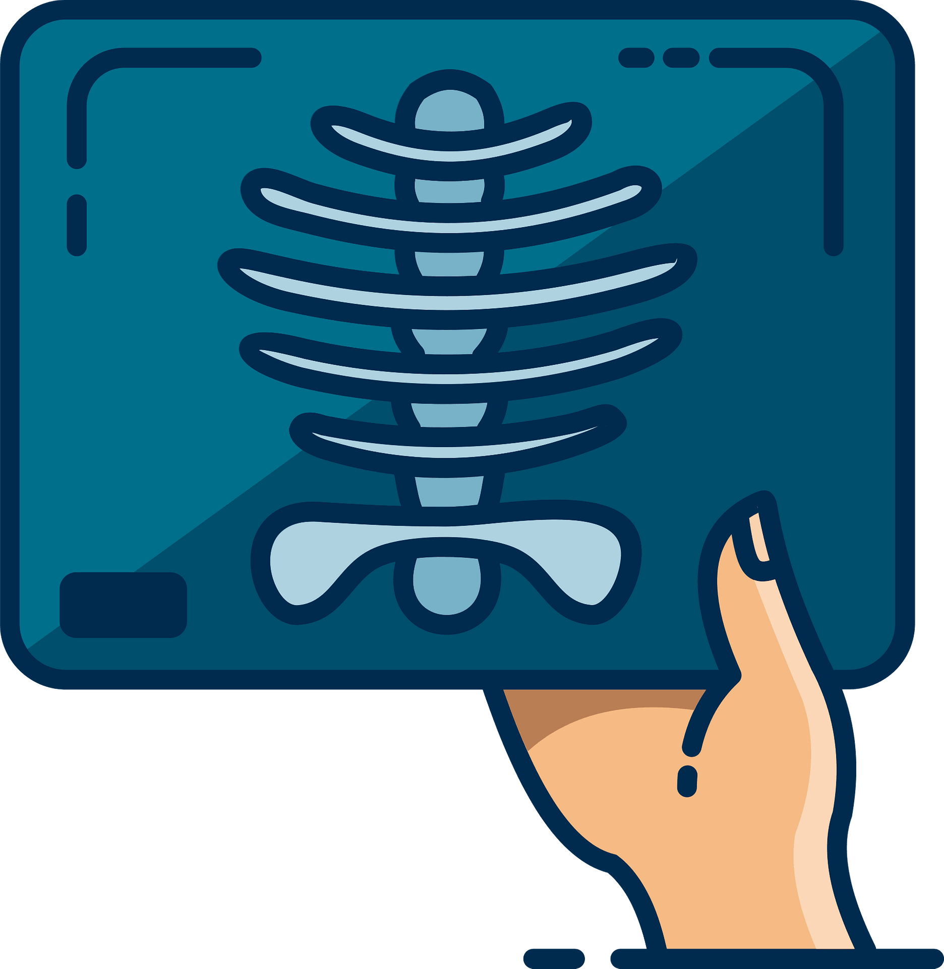 Hand Holding Blue Chest X Ray Film With Visible Rib Cage PNG Illustration