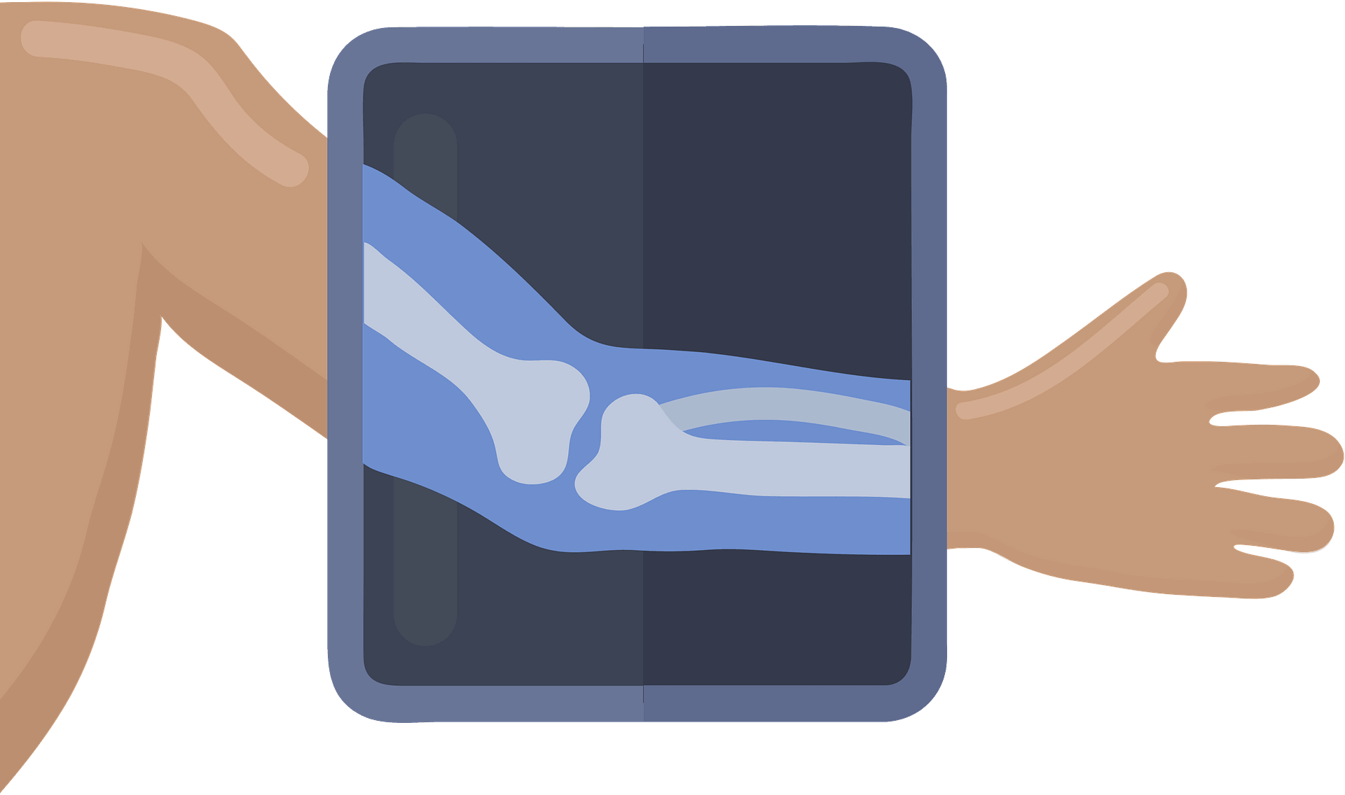 Arm X-Ray on Dark Gray Tablet Screen