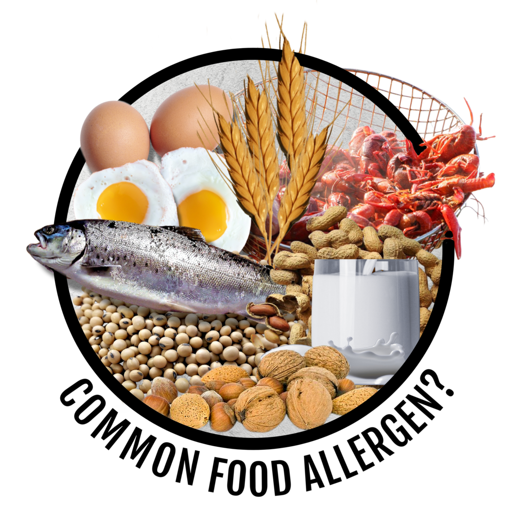 Common Food Allergens Circular Infographic With Milk Egg Fish And Wheat PNG